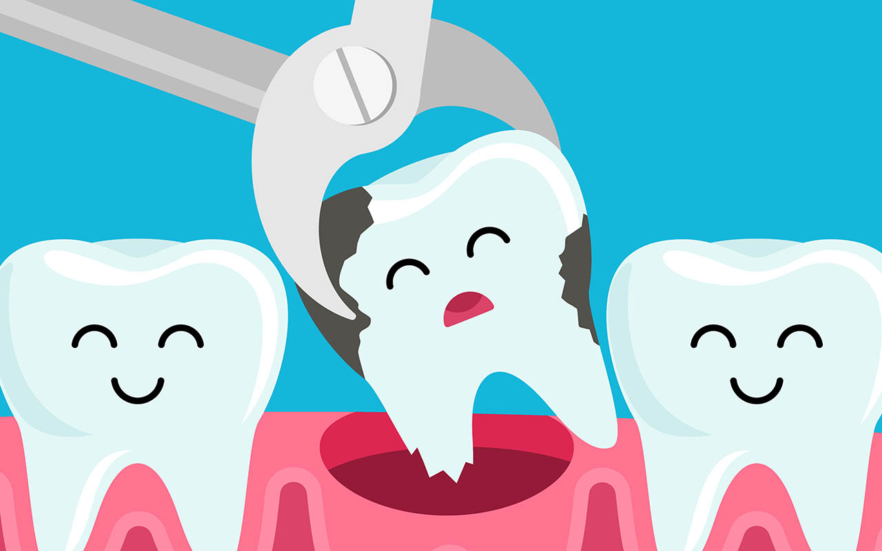Что делать после удаления зуба?