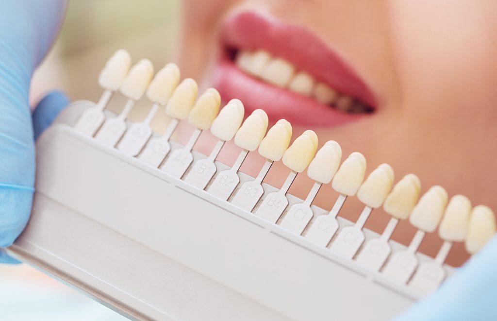 От чего зависит цвет зубной эмали?