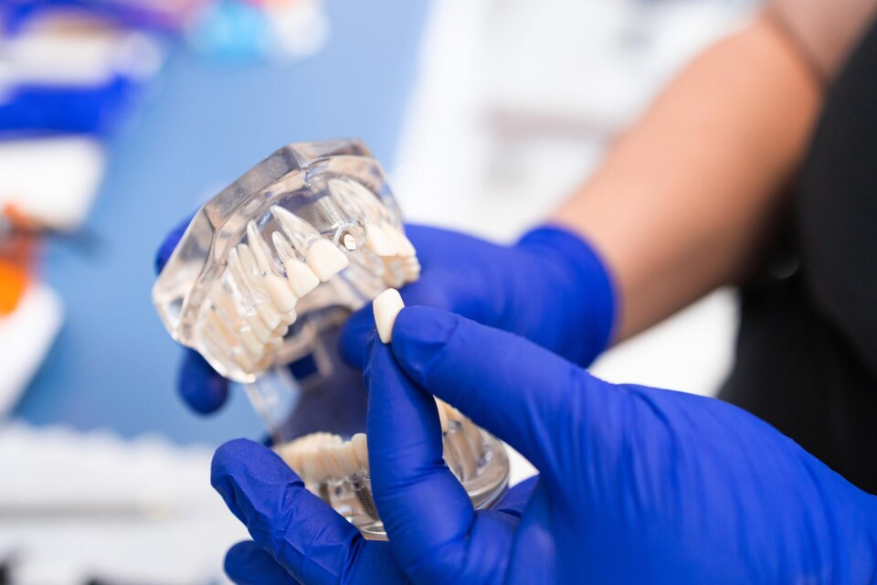 Удаление импланта зуба: что нужно знать